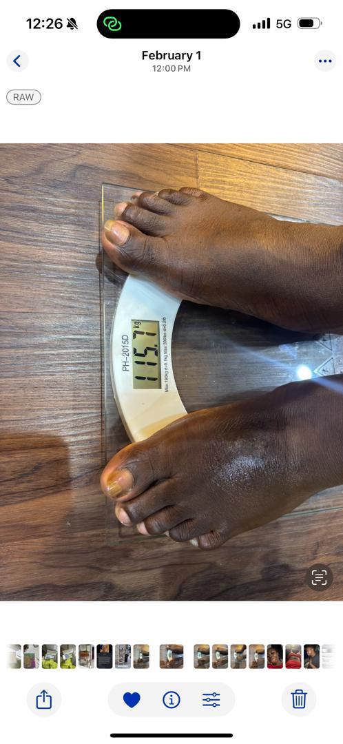 Before Mounjaro Weight Management