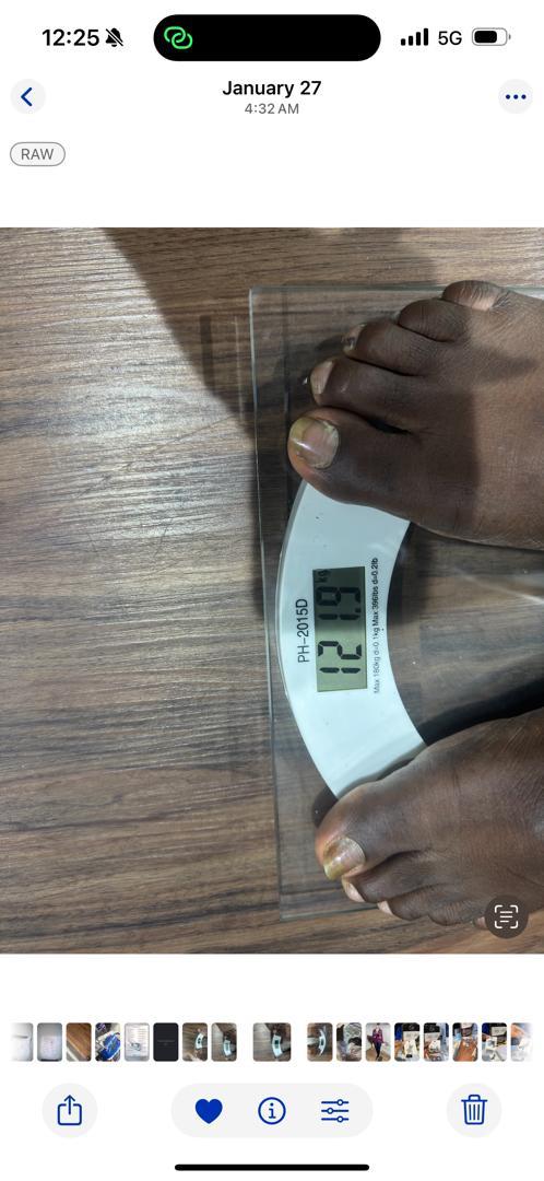 After Mounjaro Weight Management