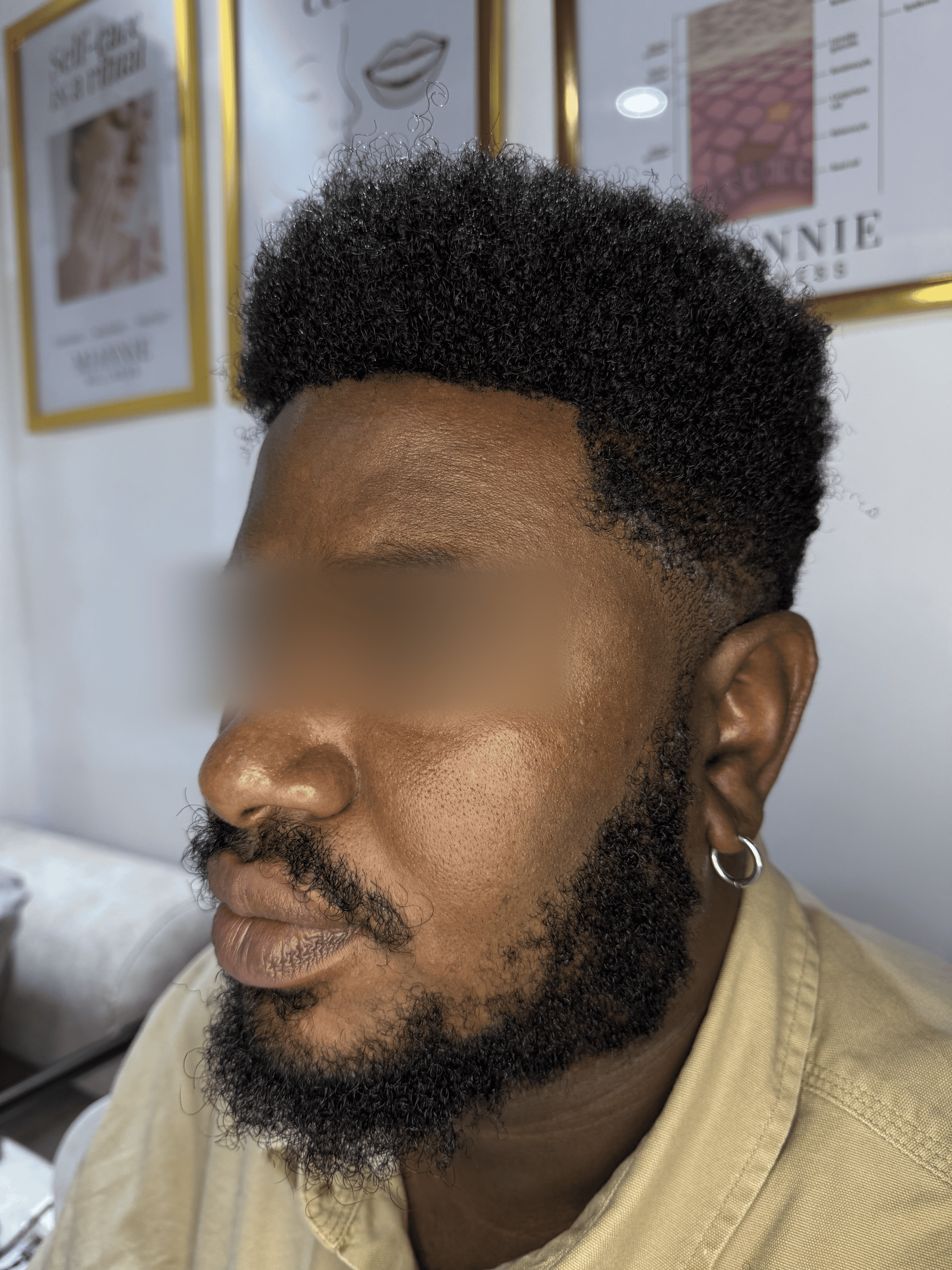 After Treatment