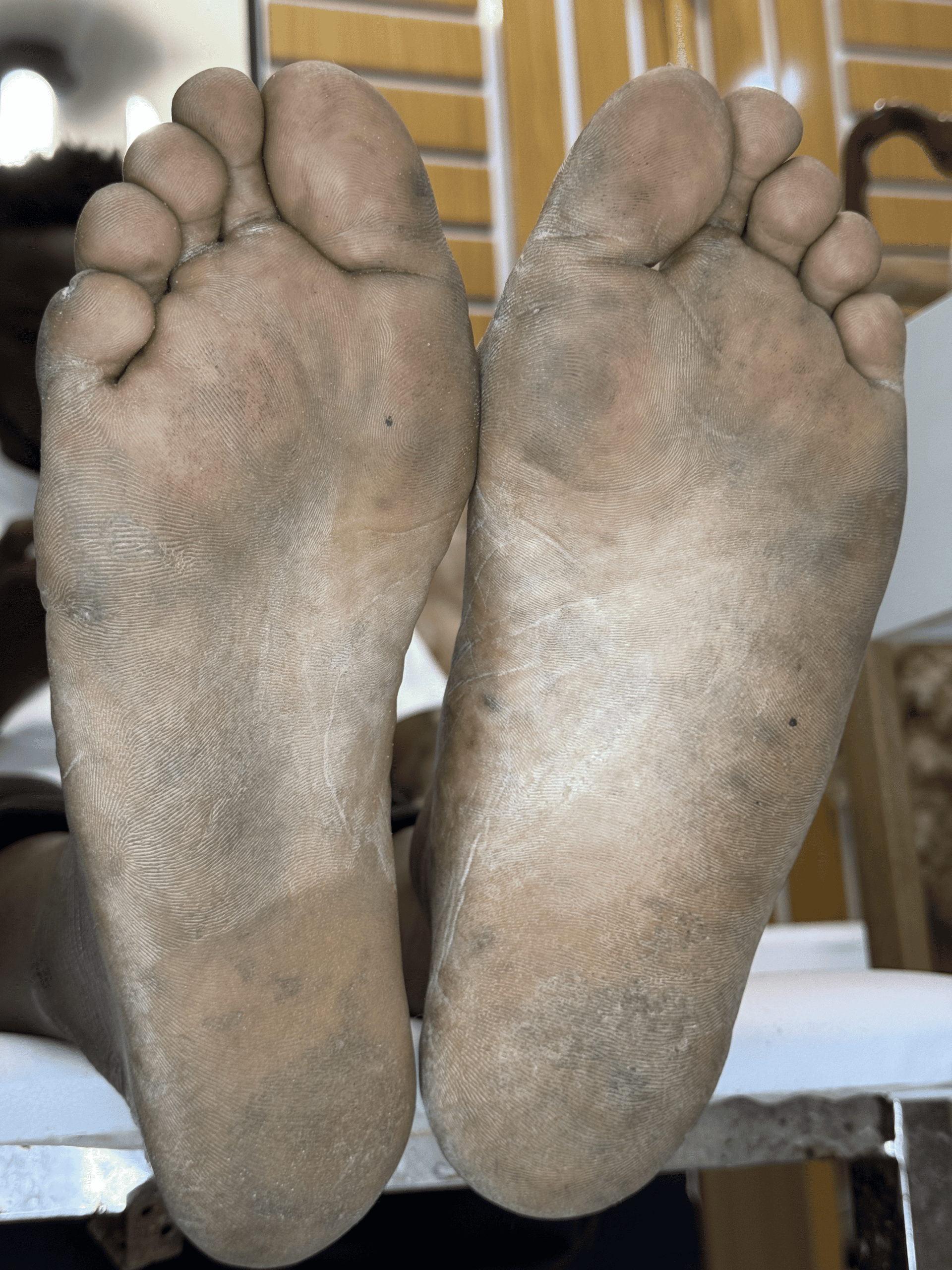 Before Cleopatra Gold Pedicure