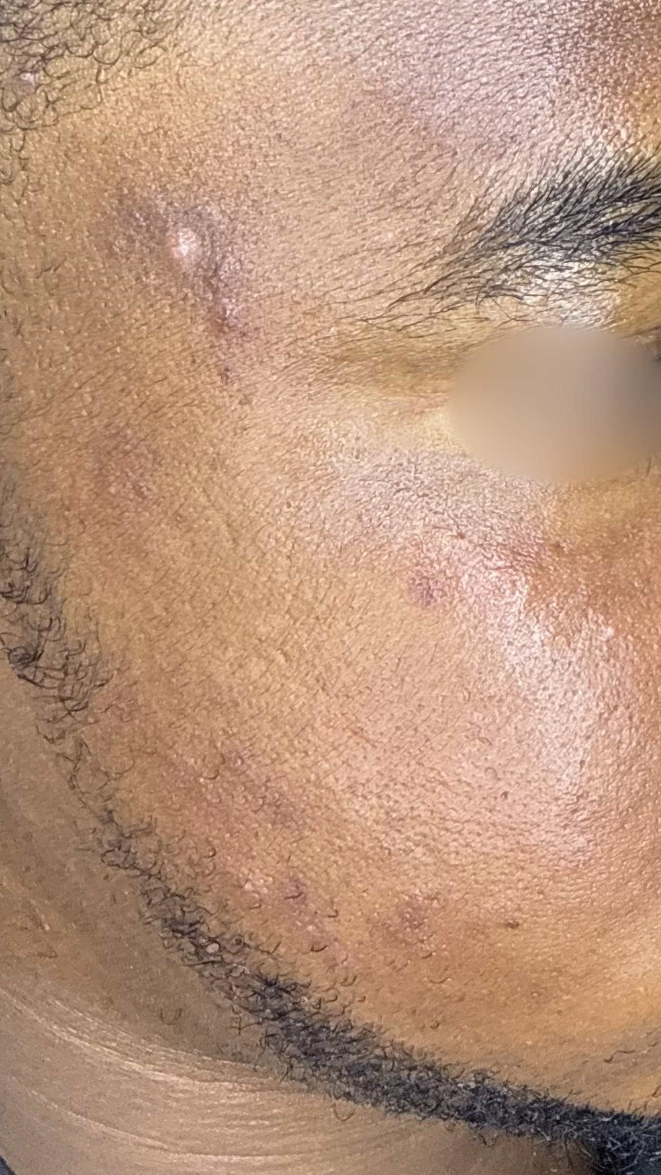 After Miannie Reset