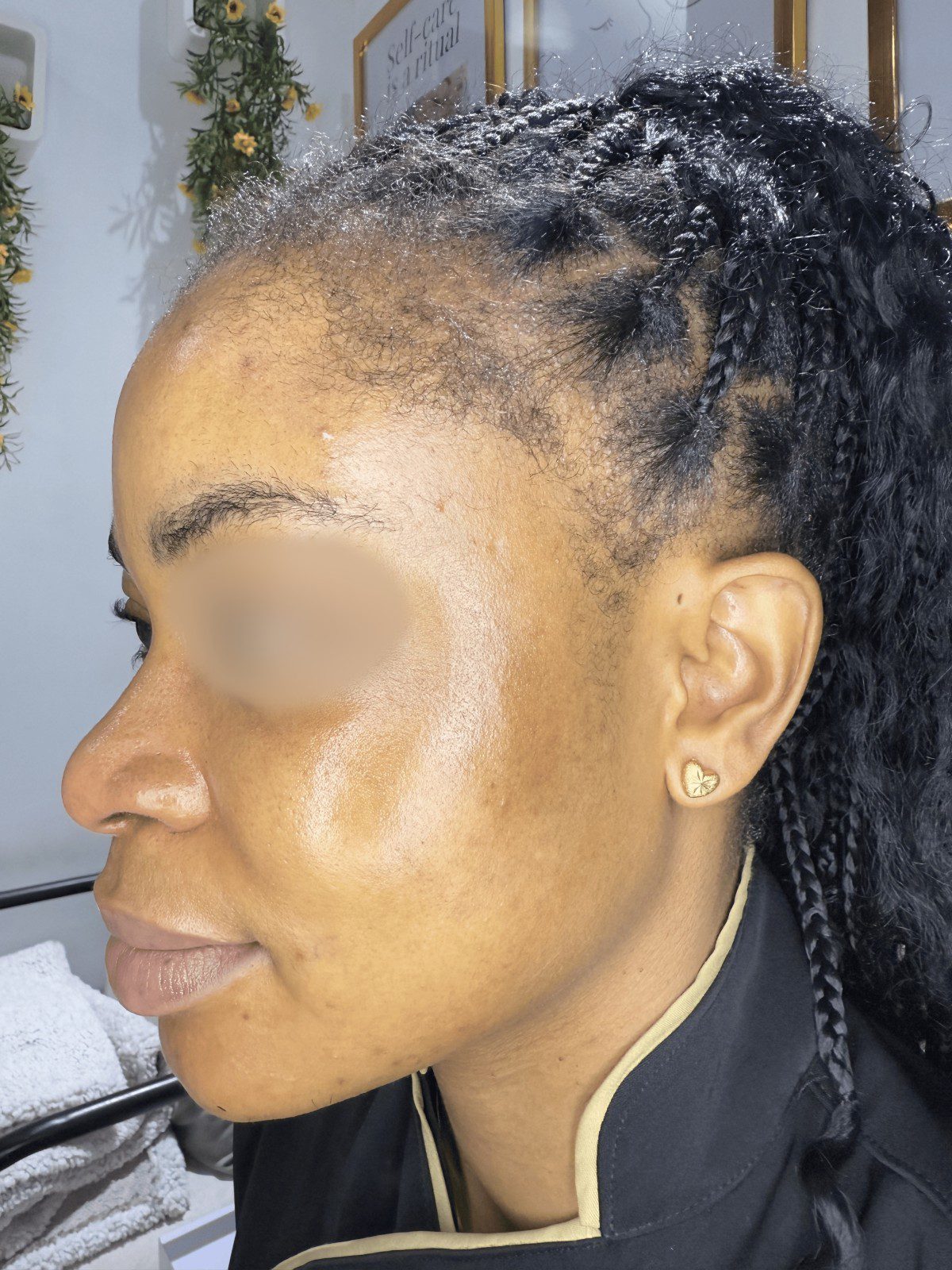 After Essential Pigment Reset