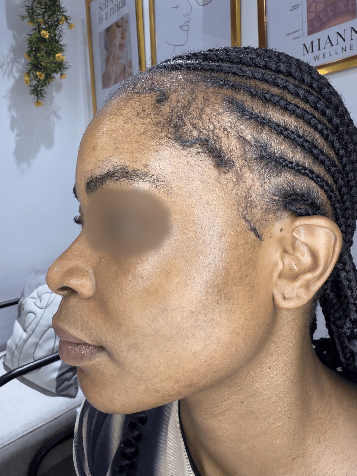 Before Essential Pigment Reset
