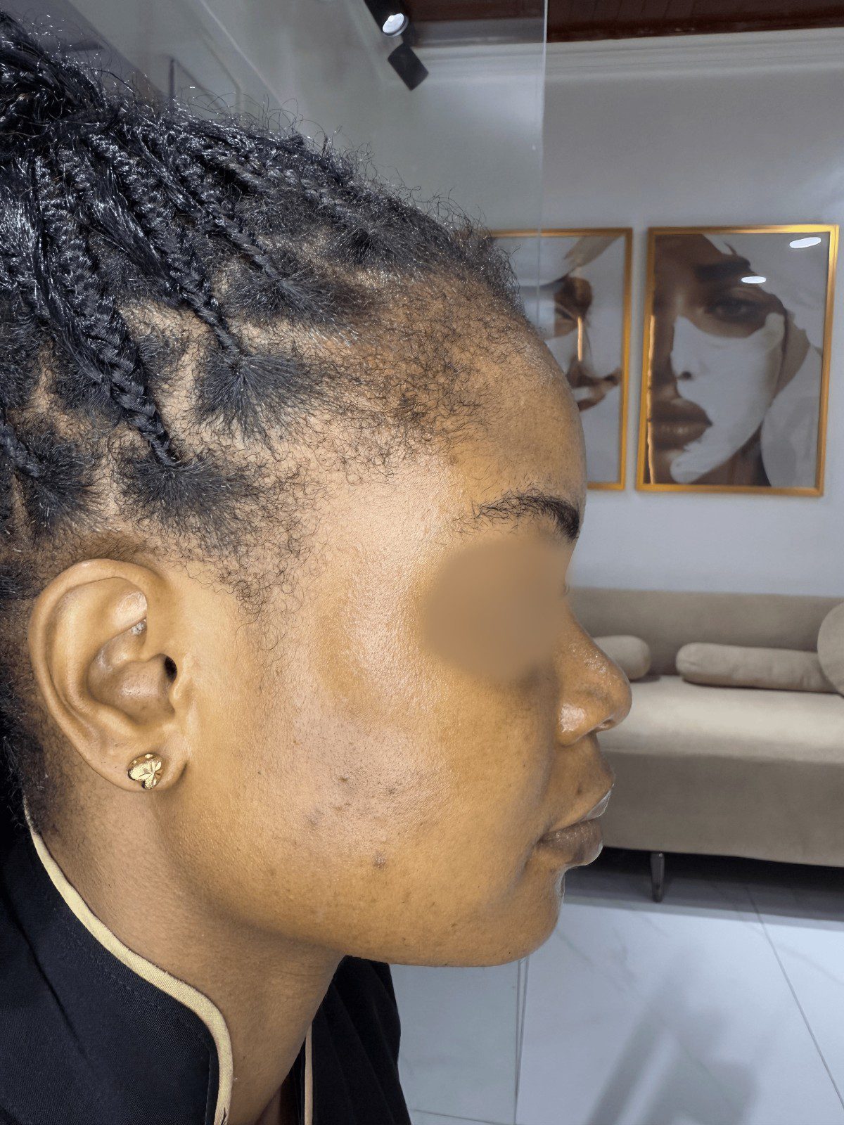 After Even Tone Renewal
