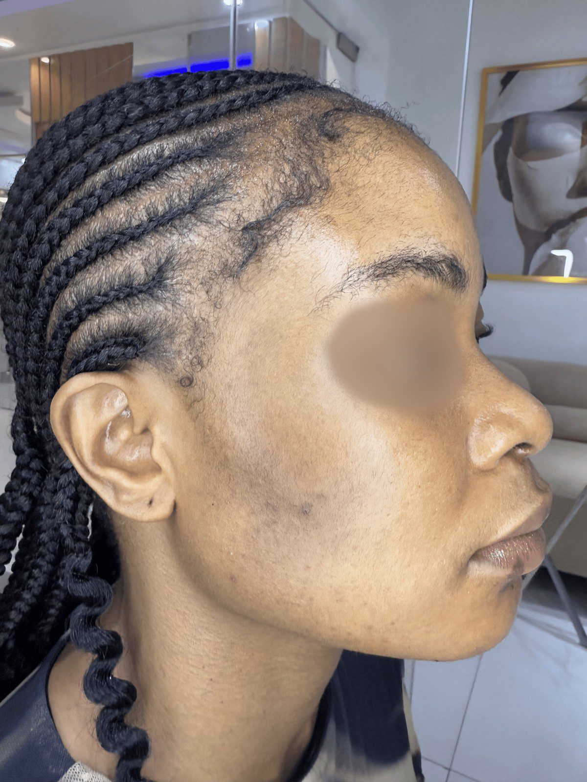 Before Even Tone Renewal